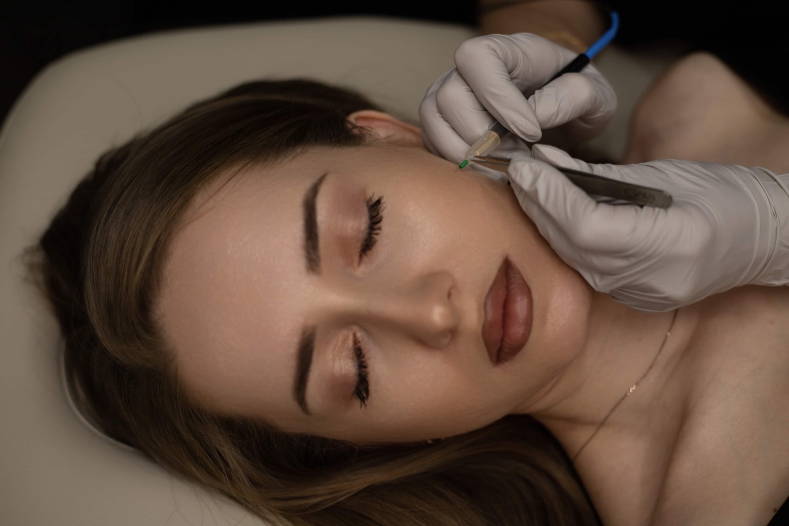 Face electrolysis treatment